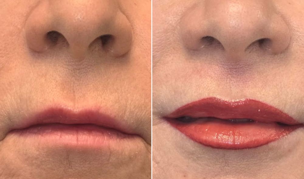 Maquillage permanent des lèvres, avant et après